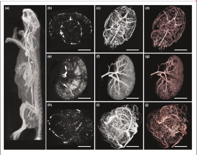 Micro-CT in small animal and specimen imaging